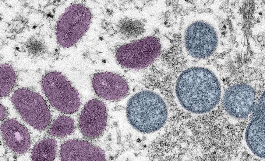 Masks return in Maasin City amid&hellip;